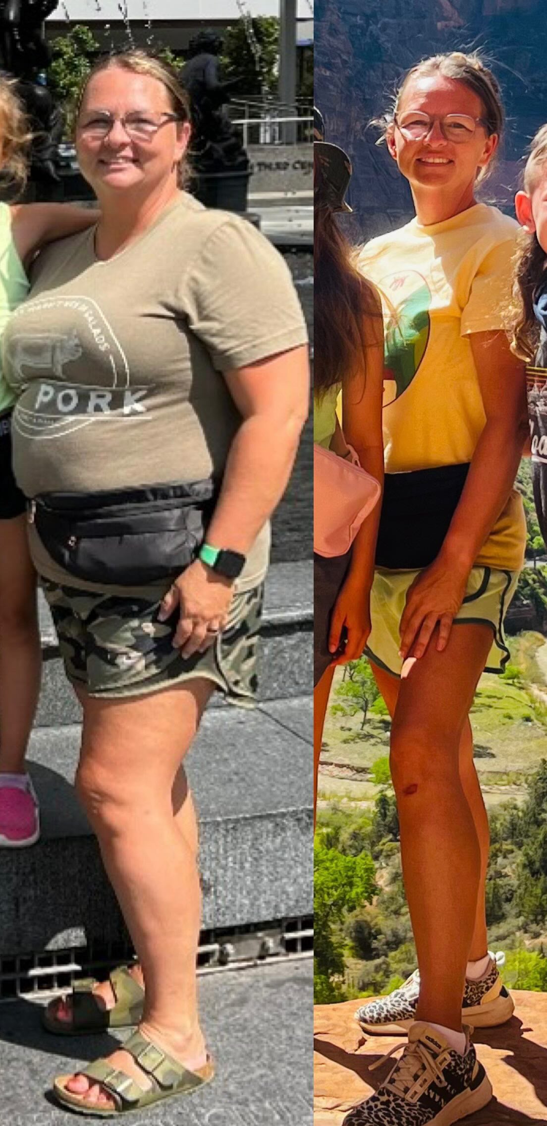 Before and after