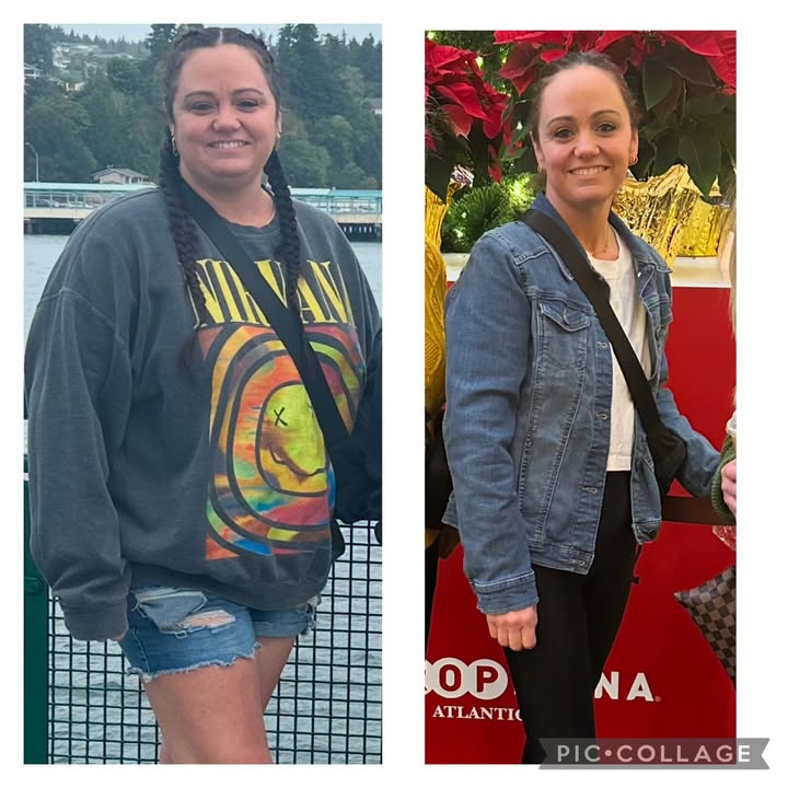 Before and after