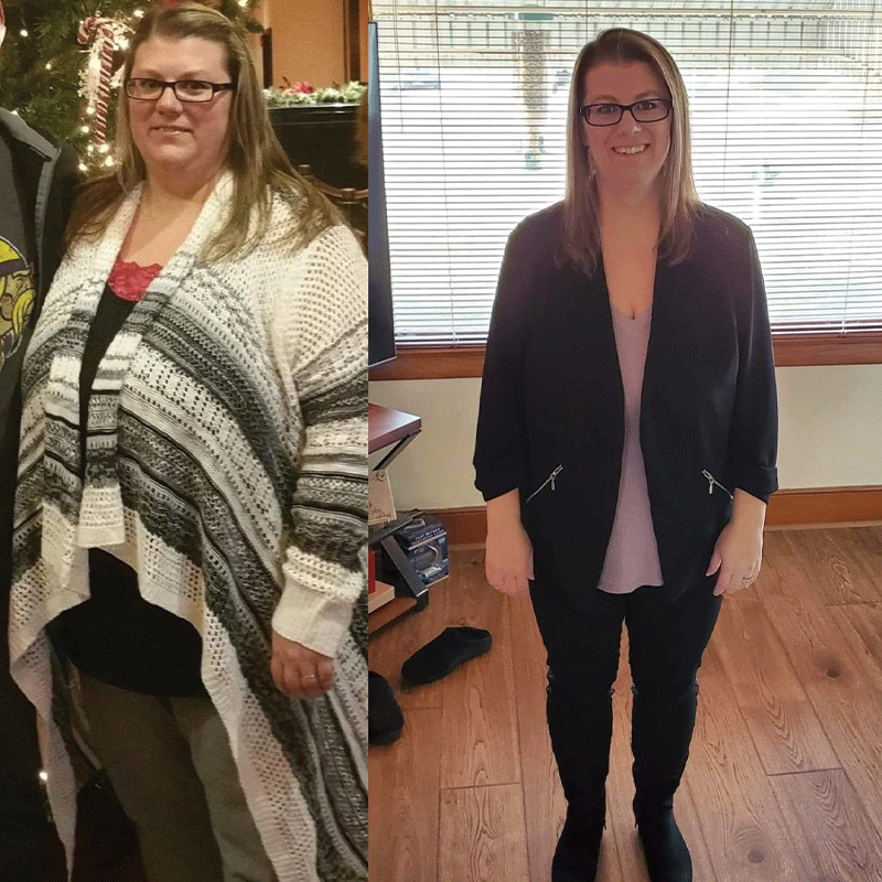 Before and after