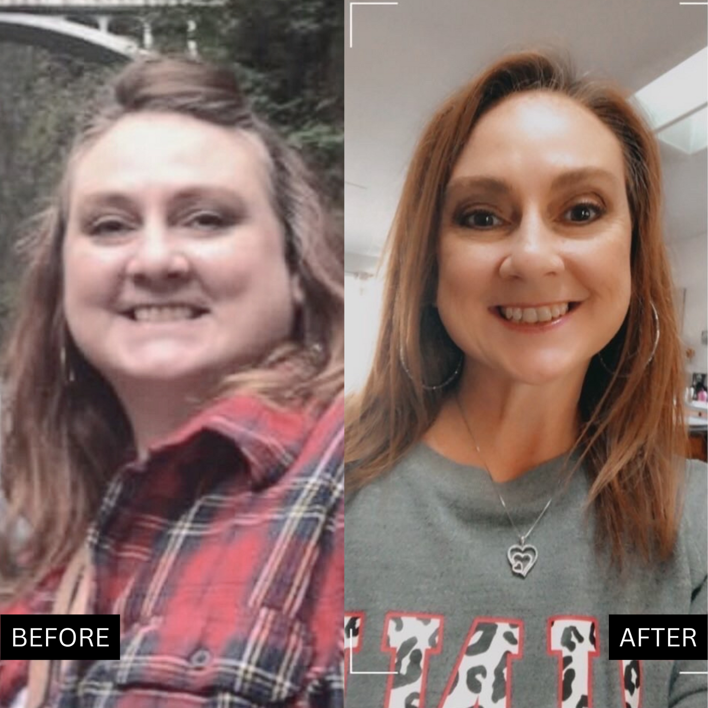 Before and after