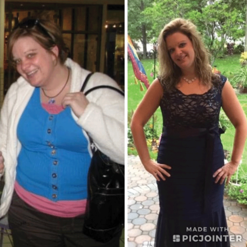 Before and after